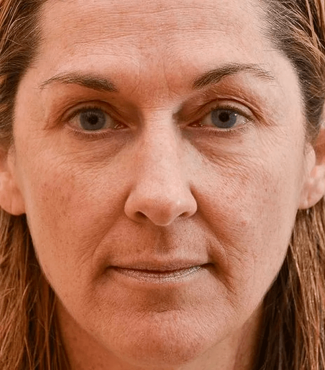 A miña cara antes de usar a crema Eudalie