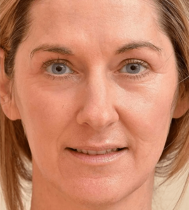 Paréceme máis novo despois de que apliquei Eudalie -cream